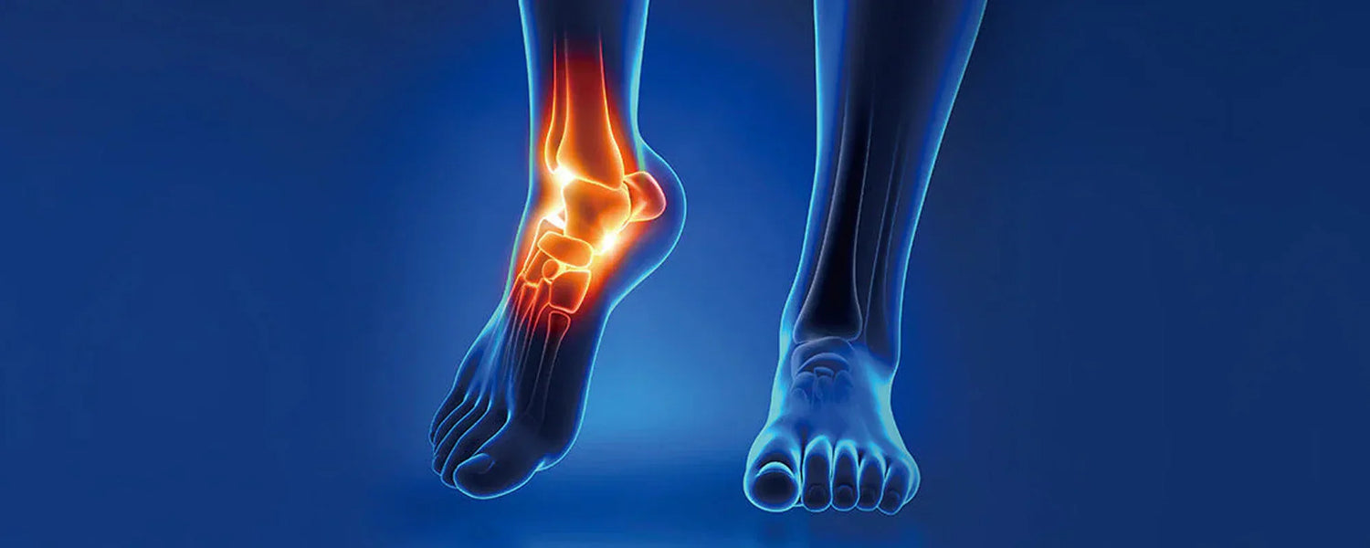 Understanding Ankle Injuries